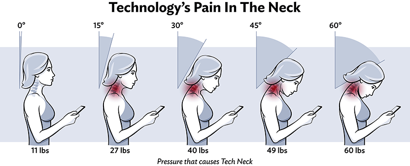 Series of women bending their necks a various degrees to look at their mobile phones.