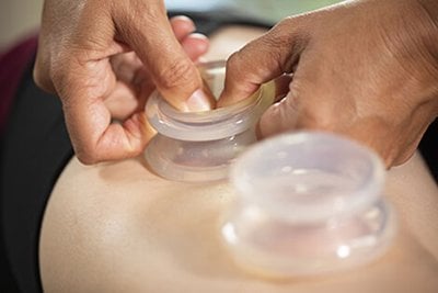 A cupping disc being depressed on the skin.